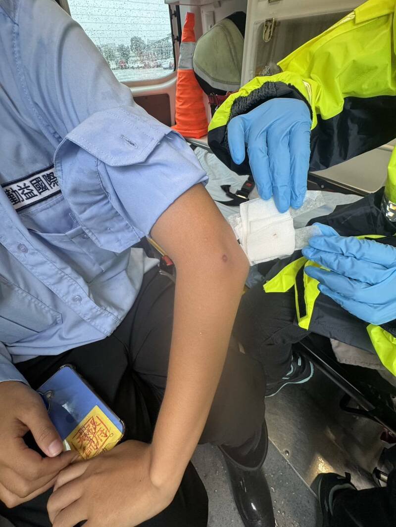 女警卫（保全）右手肘被钢珠击中，治疗后无大碍。（记者张瑞桢翻摄）