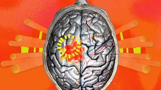 世界正变得愈来愈热,这如何影响我们的大脑