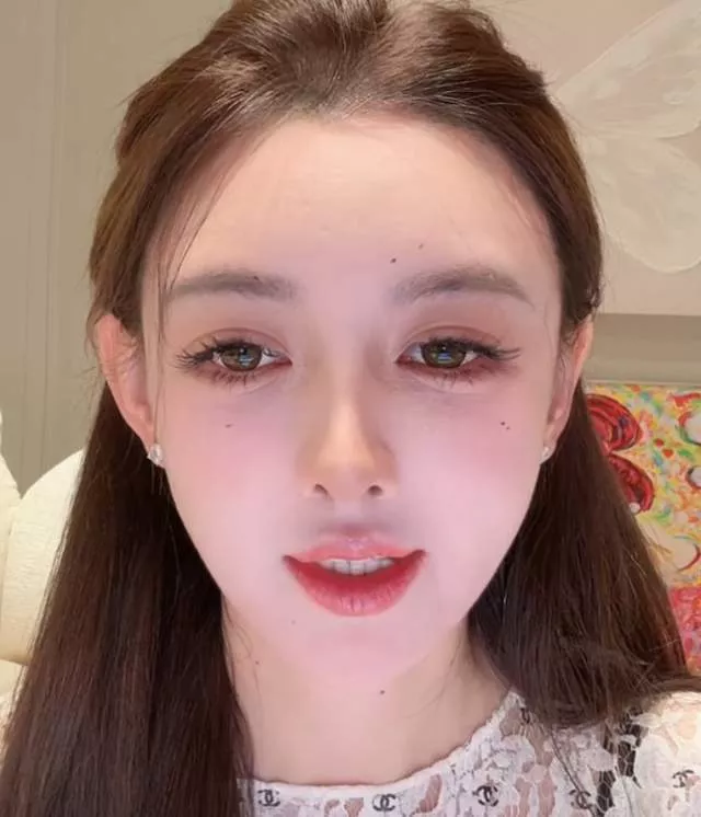 33岁叶珂真实状态曝光！医美后遗症好明显