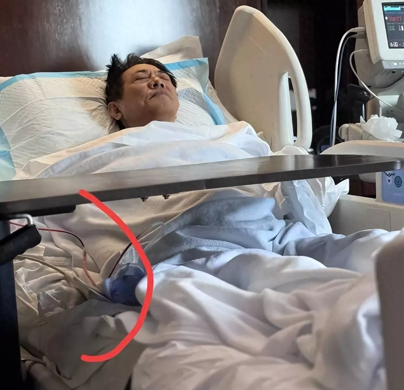 李连杰手术过程曝光价值两亿佛珠不离手,报平安才肯摘下