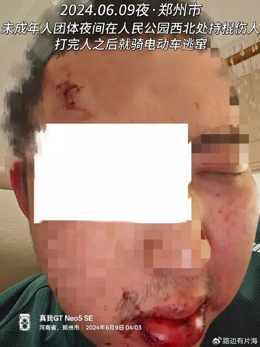 郑州围殴同性恋案：拉拉女卧底取证 却被拘留至今