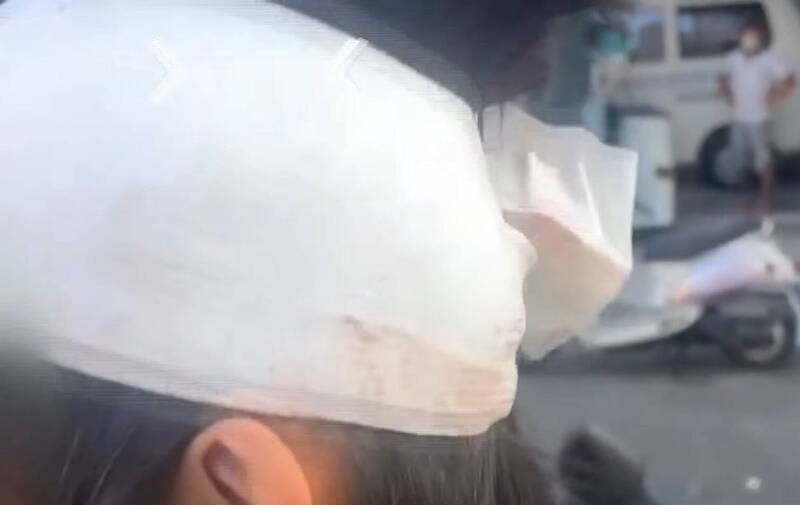 黄男今天傍晚出院时头部仍包扎纱布。（民众提供）