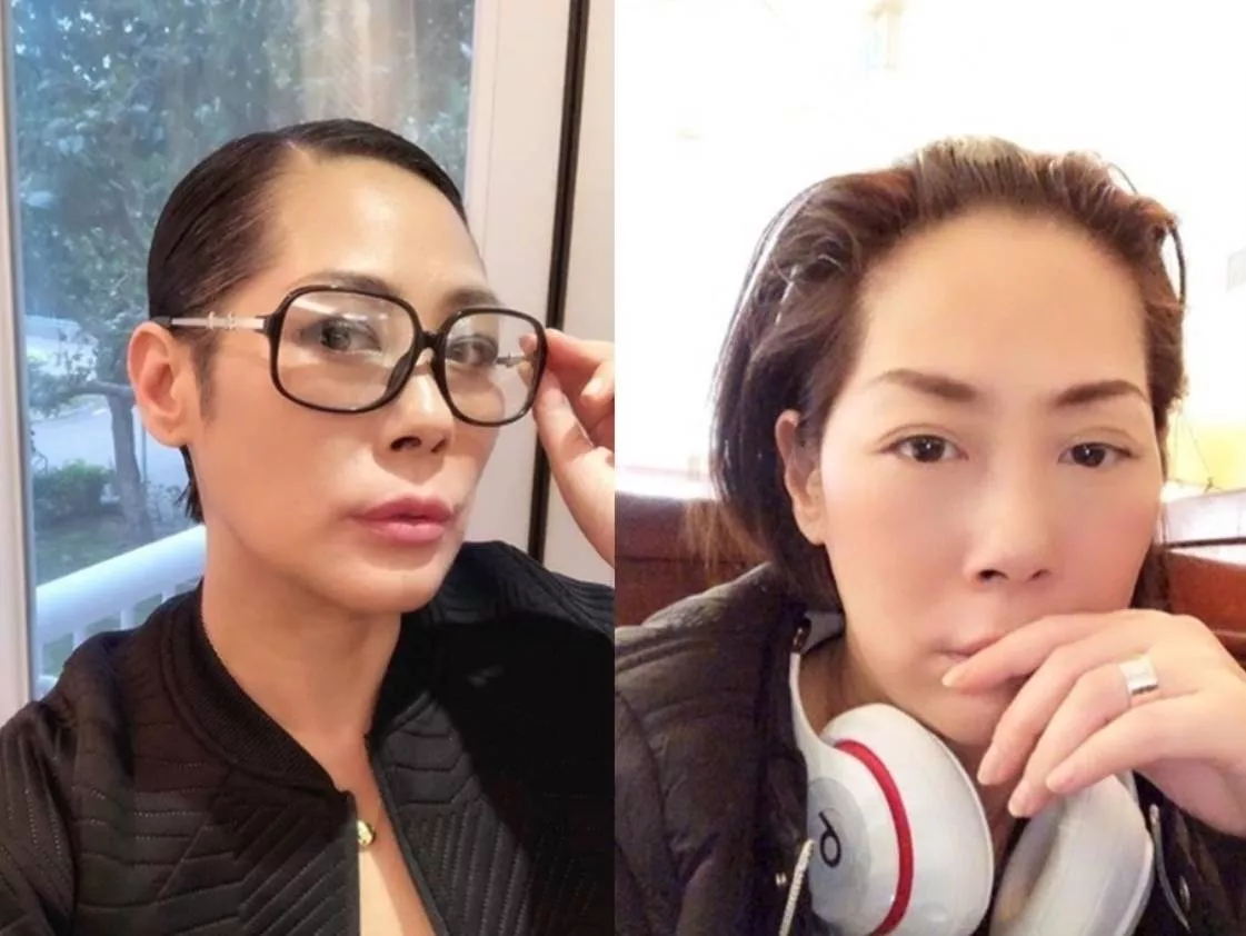 同是50+女星:叶倩文有活力,为何关淑怡却全身插管