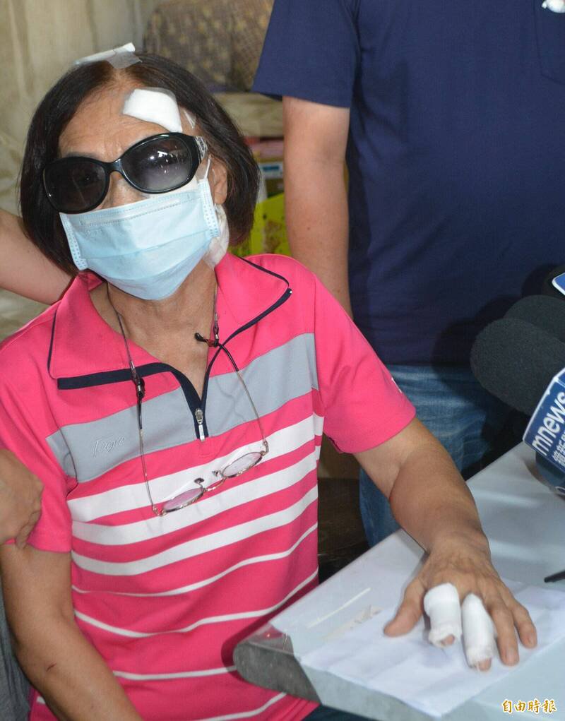 台中雾峰被砍的陈姓妇人，脸部、额头、手指头仍包著纱布。（记者陈建志摄）