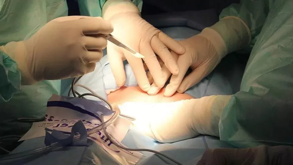 缅甸村庄“半数居民出国卖肾”!一颗能换多少钱?