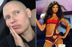 维密大秀标榜多元包容 却拒绝抗癌天使巴尔蒂登台惹议