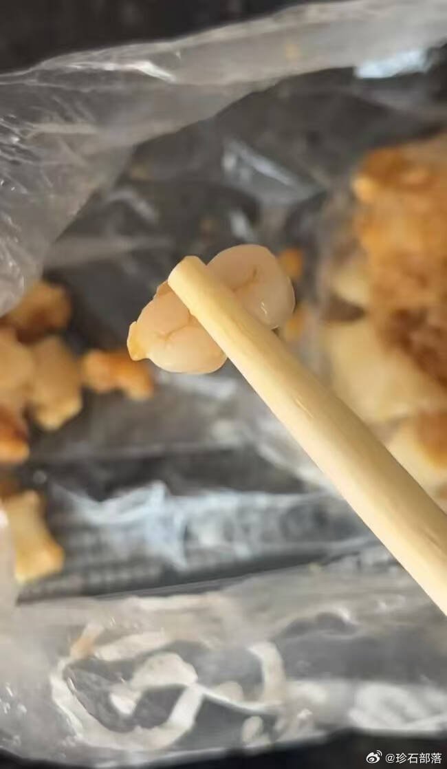 广东也有民众在吃烧卖时咬到2颗相连的牙齿。（撷取自微博）