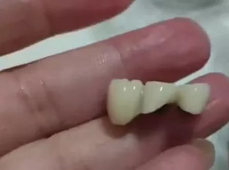 吉林香肠、东莞烧卖…接连有人吃到“人类牙齿”