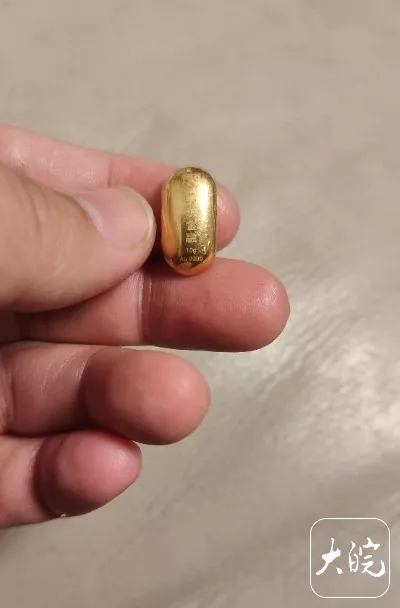 熊孩子误吞10克重金豆 妈妈:叮嘱他别在外面拉屎