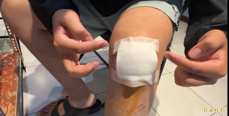 赖姓男子在基隆中山隧道看到长发女子后连日心神不宁摔车，手肘和膝盖受伤。（记者卢贤秀摄）