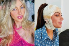 整形27次为成芭比梦!巴西女网红惊传「半裸陈尸」51岁男家中