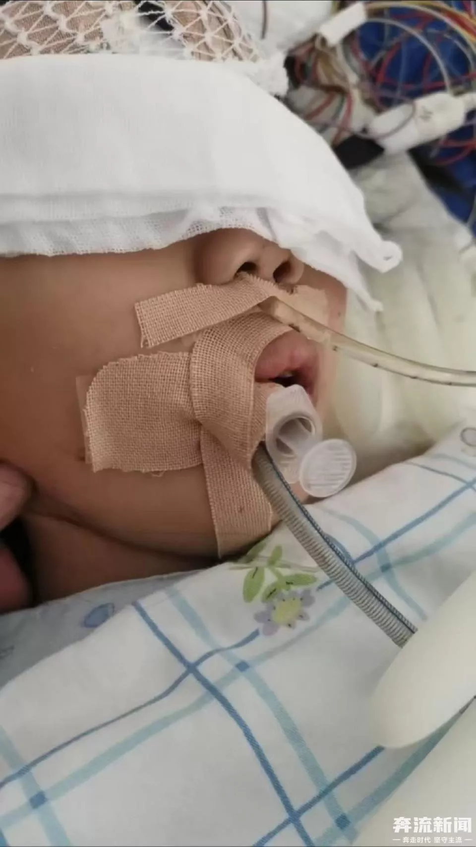 9岁女童术后成了植物人,医院多科室医护人员篡改病历