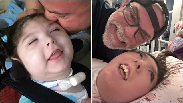 「天生无脑」被医判活不到5岁!她奇迹庆祝20岁生日