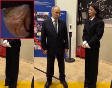 健康亮红灯?普廷右手「诡异肿胀」 不自然握拳影像疯传