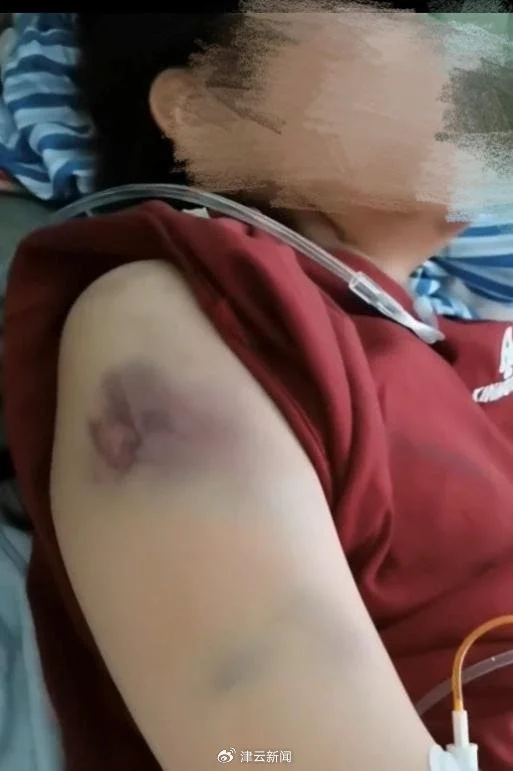 女子遭家暴开车逃跑撞死丈夫,父亲:望判女儿无罪