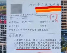 中国男性患者电脑断层报告出现「子宫」！ 医院解释了