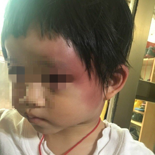 父遇暴雨被砸车刚枉死，3岁曾小妺妺由父亲托友人照顾又受虐。（家属提供）