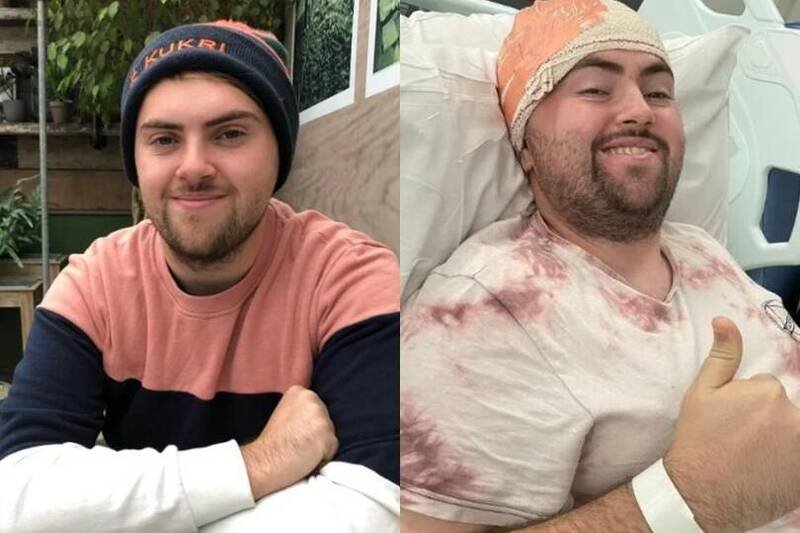 英国男子长期饱受头痛与肢体发麻之苦，检查后竟被诊断为「第3级星状细胞瘤」。（图截自Brain Tumour Research）