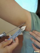 爱美女抽脂险丢小命 5次鉴定均认医师没疏失